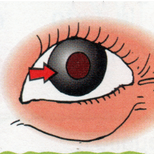Lunou mato