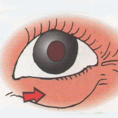 Bodtung mato / eye bag / beg mata